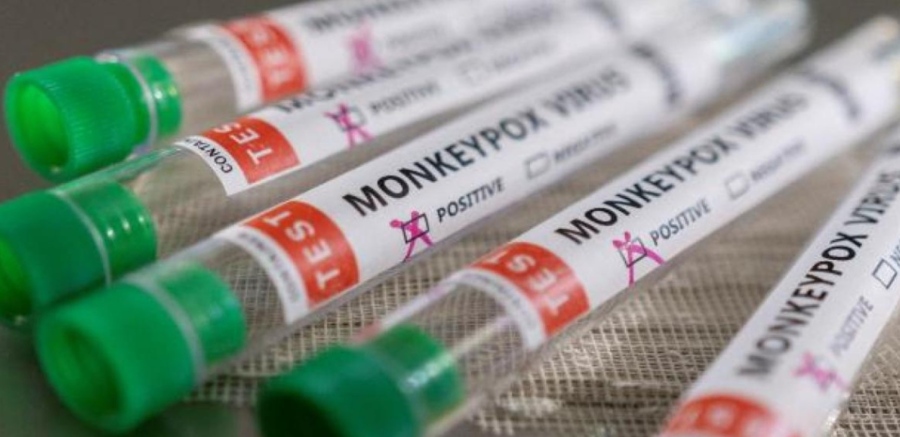 България изготви инструкции за диагностика на маймунската шарка